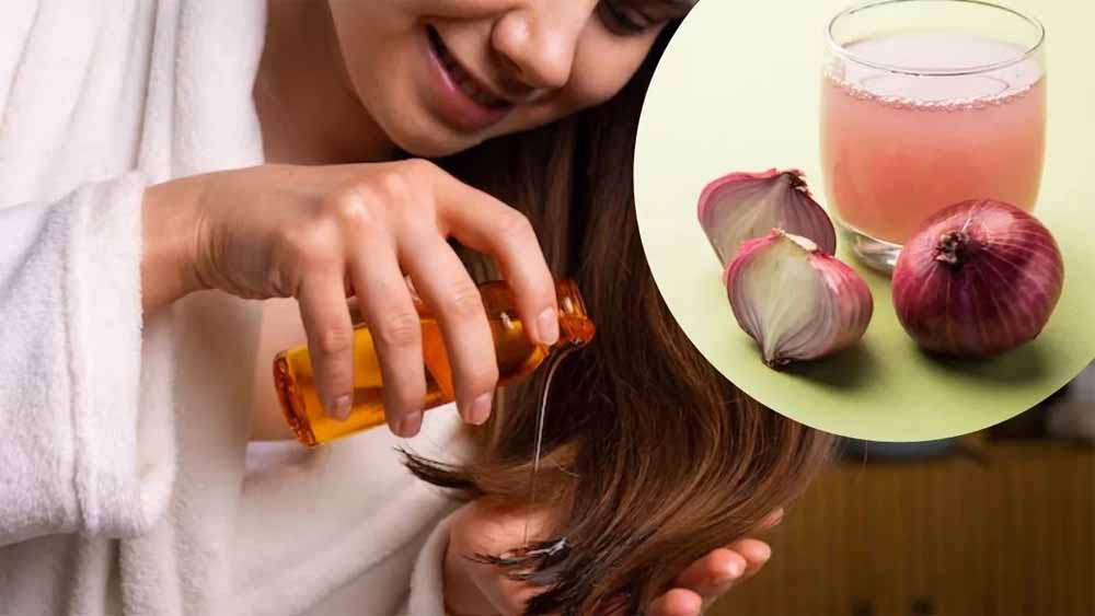 प्याज का तेल: हेयर फॉल रोकने का घरेलू नुस्खा